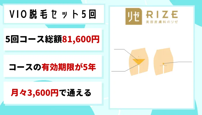 VIOリゼクリニックおすすめプラン