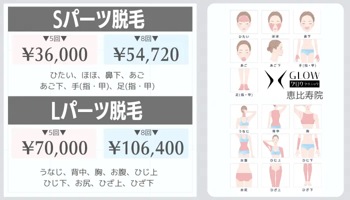 グロウクリニック恵比寿Sパーツ・Lパーツ脱毛料金