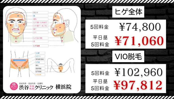渋谷美容外科クリニックメンズ横浜比較料金