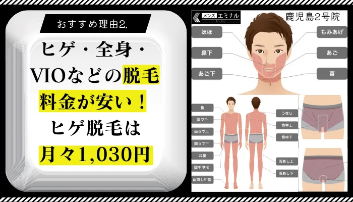 メンズエミナル鹿児島2号おすすめ理由2