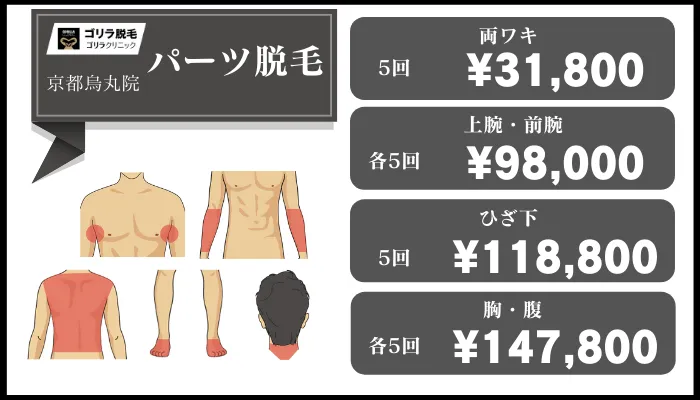 ゴリラクリニック京都烏丸その他パーツ料金