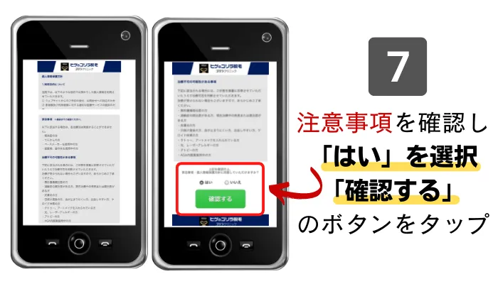 ゴリラクリニック京都烏丸カウンセリング予約7