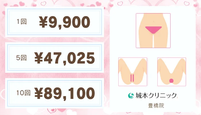 城本クリニック比較おすすめプランVIO