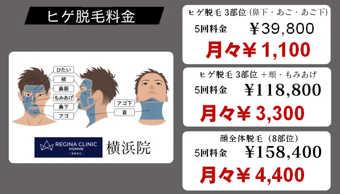レジーナクリニックオム横浜ヒゲ脱毛料金