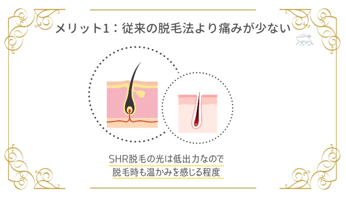 SHR脱毛のメリット1