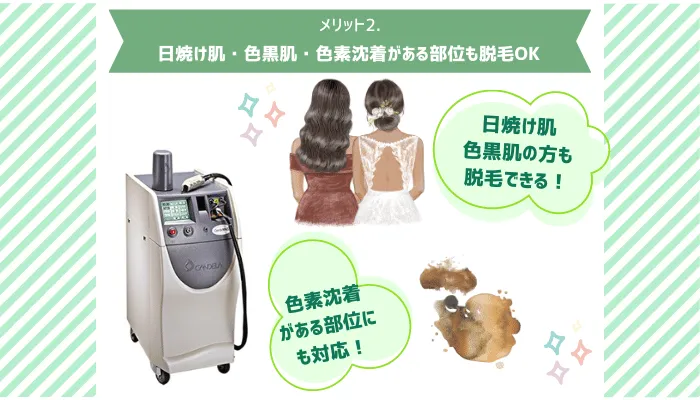 YAGレーザーメリット2