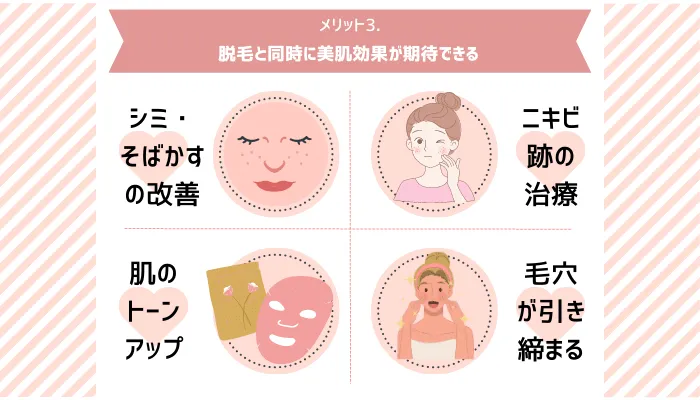 アレキサンドライトレーザーメリット3