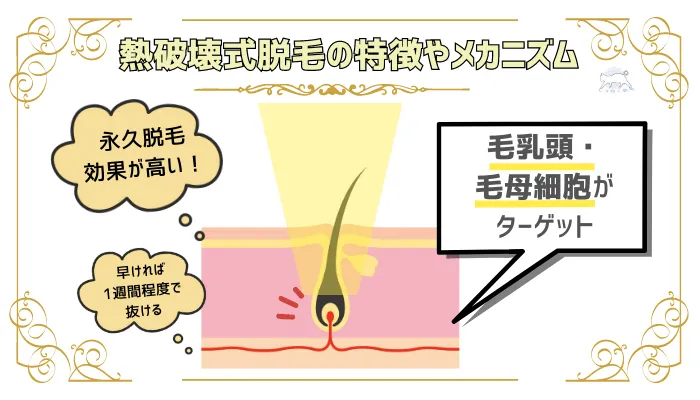 熱破壊式脱毛の特徴やメカニズム