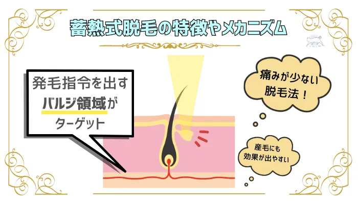 蓄熱式脱毛の特徴やメカニズム