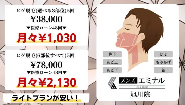 メンズエミナル旭川比較料金ヒゲ